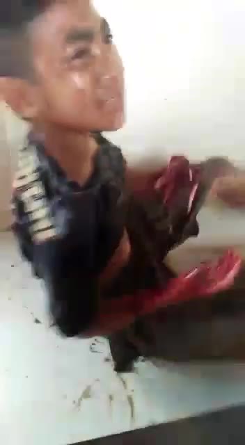 Darah!!!! Jangan Dilihat Jika Takut